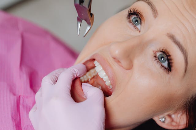 tooth extractions near me