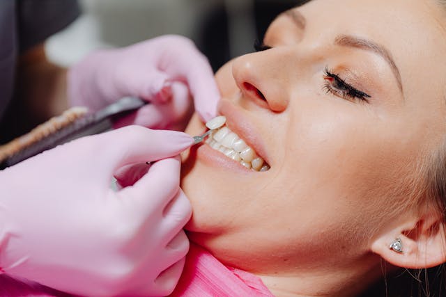 dentist for dental veneers in newmarket